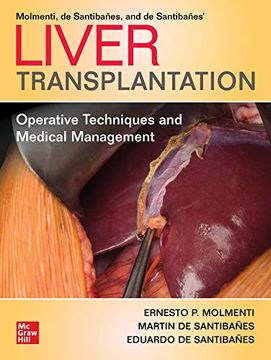 portada Liver Transplantation: Operative Techniques and Medical Management (in English)