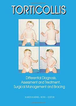 portada Torticollis: Differential Diagnosis, Assessment and Treatment, Surgical Management and Bracing (Physical and Occupational Therapy in Pediatrics) (in English)