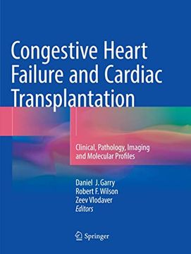 portada Congestive Heart Failure and Cardiac Transplantation: Clinical, Pathology, Imaging and Molecular Profiles (in English)