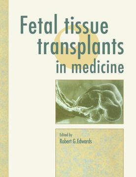 portada Fetal Tissue Transplants in Medicine (en Inglés)