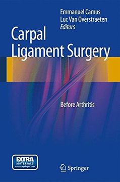 portada carpal ligament surgery: before arthritis