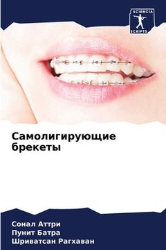 portada Самолигирующие брекеты (in Russian)