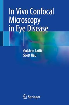 portada In Vivo Confocal Microscopy in Eye Disease (en Inglés)