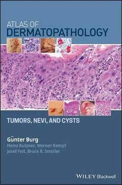 portada Atlas of Dermatopathology: Tumors, Nevi, and Cysts (en Inglés)