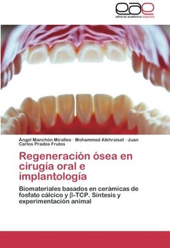 portada Regeneracion Osea En Cirugia Oral E Implantologia