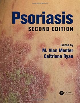 portada Psoriasis (in English)