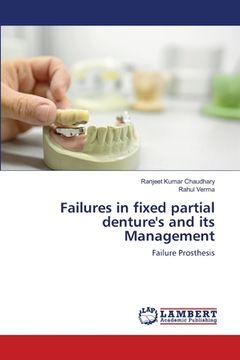 portada Failures in fixed partial denture's and its Management (en Inglés)