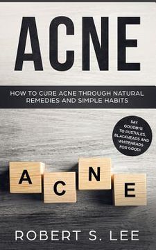 portada Acne: How to Cure Acne through Natural Remedies and Simple Habits. Say Goodbye to Pustules, Blackheads and Whiteheads for Go (en Inglés)