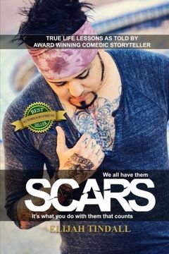 portada Scars: We all have them, it's what we do with them that counts