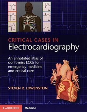 portada Critical Cases in Electrocardiography: An Annotated Atlas of Don't-Miss Ecgs for Emergency Medicine and Critical Care (en Inglés)