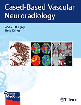 portada Imaging in Neurovascular Disease: A Case-Based Approach (en Inglés)