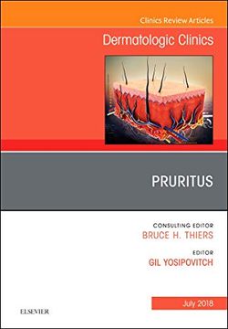 portada Pruritus, an Issue of Dermatologic Clinics (Volume 36-3) (The Clinics: Dermatology, Volume 36-3)
