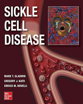 portada Sickle Cell Disease (en Inglés)