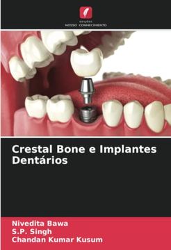 portada Crestal Bone e Implantes Dent�Rios