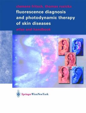 portada Fluorescence Diagnosis and Photodynamic Therapy of Skin Diseases: Atlas and Handbook (en Inglés)
