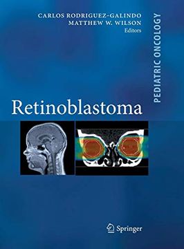 portada Retinoblastoma (Pediatric Oncology) 