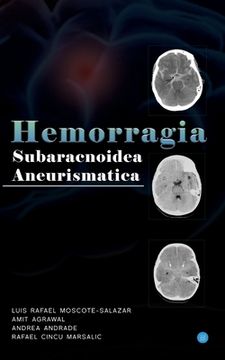 portada Hemorragia Subaracnoidea Aneurismatica (en Inglés)