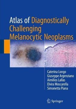 portada Atlas of Diagnostically Challenging Melanocytic Neoplasms