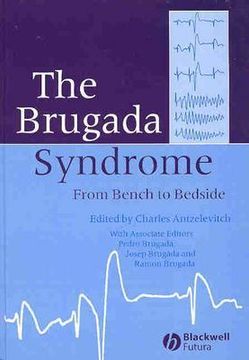portada The Brugada Syndrome: From Bench to Bedside (in English)