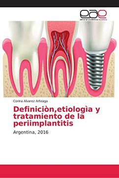 portada Definiciòn,Etiologìa y Tratamiento de la Periimplantitis: Argentina, 2016