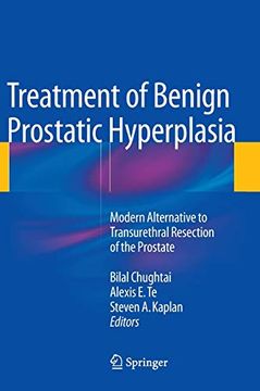 portada Treatment of Benign Prostatic Hyperplasia: Modern Alternative to Transurethral Resection of the Prostate (en Inglés)