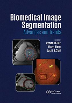 portada Biomedical Image Segmentation: Advances and Trends (en Inglés)