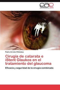 portada Cirugia de Catarata e Istent Glaukos en el Tratamiento del Glaucoma (in Spanish)