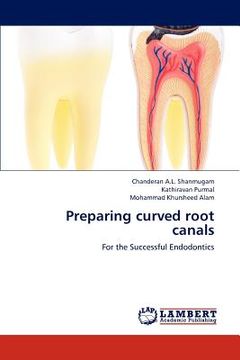 portada preparing curved root canals (en Inglés)
