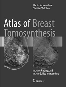 portada Atlas of Breast Tomosynthesis: Imaging Findings and Image-Guided Interventions (in English)