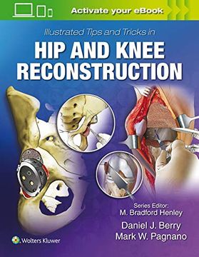 portada Illustrated Tips and Tricks in Hip and Knee Reconstructive and Replacement Surgery (in English)