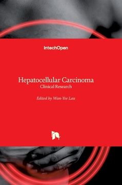 portada Hepatocellular Carcinoma: Clinical Research (in English)