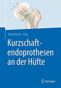 portada Kurzschaftendoprothesen an der Hüfte (German Edition)