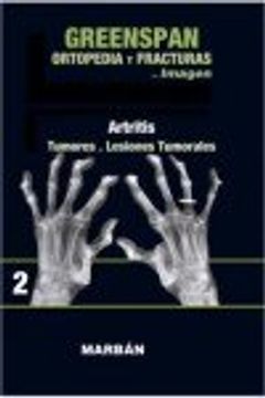 portada Ortopedia y Fracturas. Vol 2. Artritis. Tumores. Lesiones tumorales