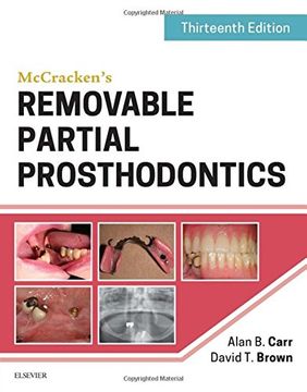 portada McCracken's Removable Partial Prosthodontics, 13e