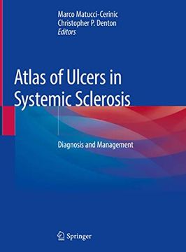 portada Atlas of Ulcers in Systemic Sclerosis: Diagnosis and Management (en Inglés)