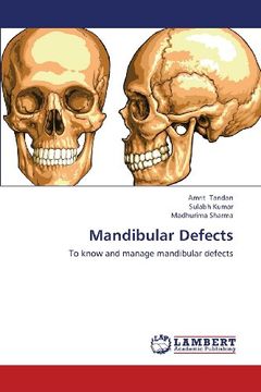 portada Mandibular Defects