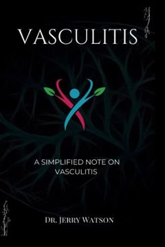 portada Vasculitis: A simplified note on vasculitis (en Inglés)
