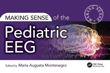 portada Making Sense of the Pediatric eeg (en Inglés)