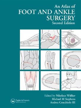 portada Atlas Foot and Ankle Surgery (en Inglés)