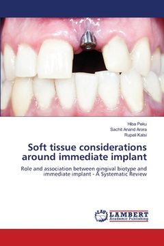 portada Soft tissue considerations around immediate implant (in English)