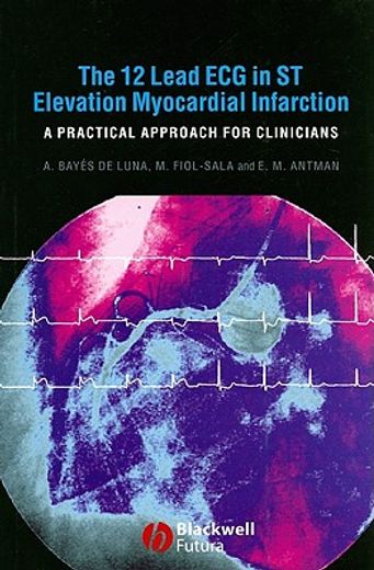 The 12-Lead ECG in ST Elevation Myocardial Infarction: A Practical Approach for Clinicians