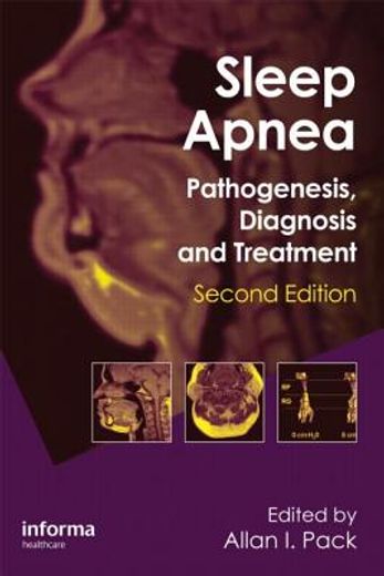 sleep apnea,pathogenesis, diagnosis and treatment