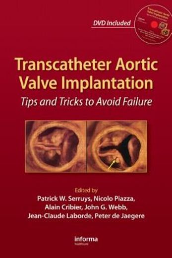 Transcatheter Aortic Valve Implantation: Tips and Tricks to Avoid Failure [With DVD] (in English)