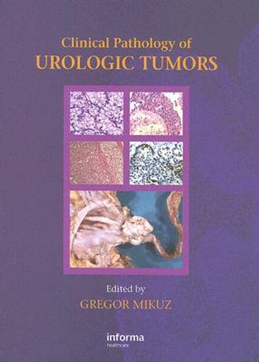Clinical Pathology of Urological Tumours (en Inglés)