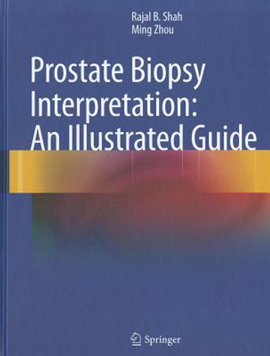 prostate biopsy interpretation