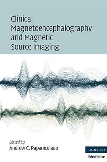 clinical magnetoencephalography and magnetic source imaging