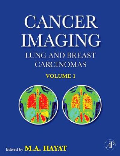 cancer imaging,lung and breast carcinomas