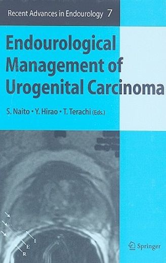 endourological management of urogenital carcinoma