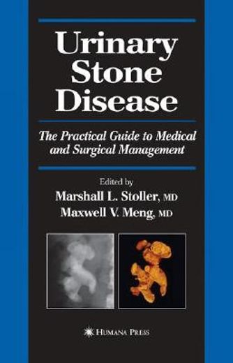 urinary stone disease,the practical guide to medical and surgical management