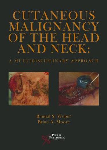 cutaneous malignancy of the head and neck,a multidisciplinary approach